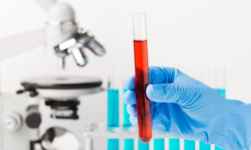 A importância da terceirização de exames laboratoriais para clínicas e hospitais