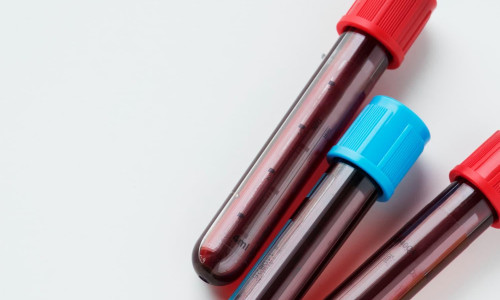 Jejum para exames de sangue: como funciona e no que influencia