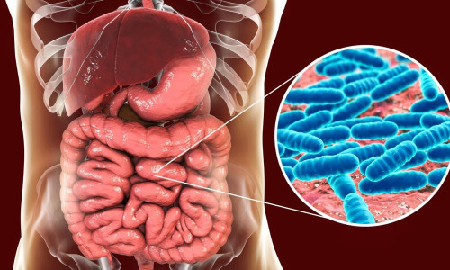 Entenda como é feito o exame de microbioma intestinal