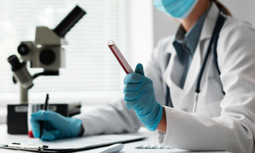 Diagnóstico laboratorial da coqueluche: quando e como realizar os exames