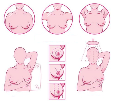 Breast Cancer, Prevention and Self-Examination - Diagnósticos do Brasil