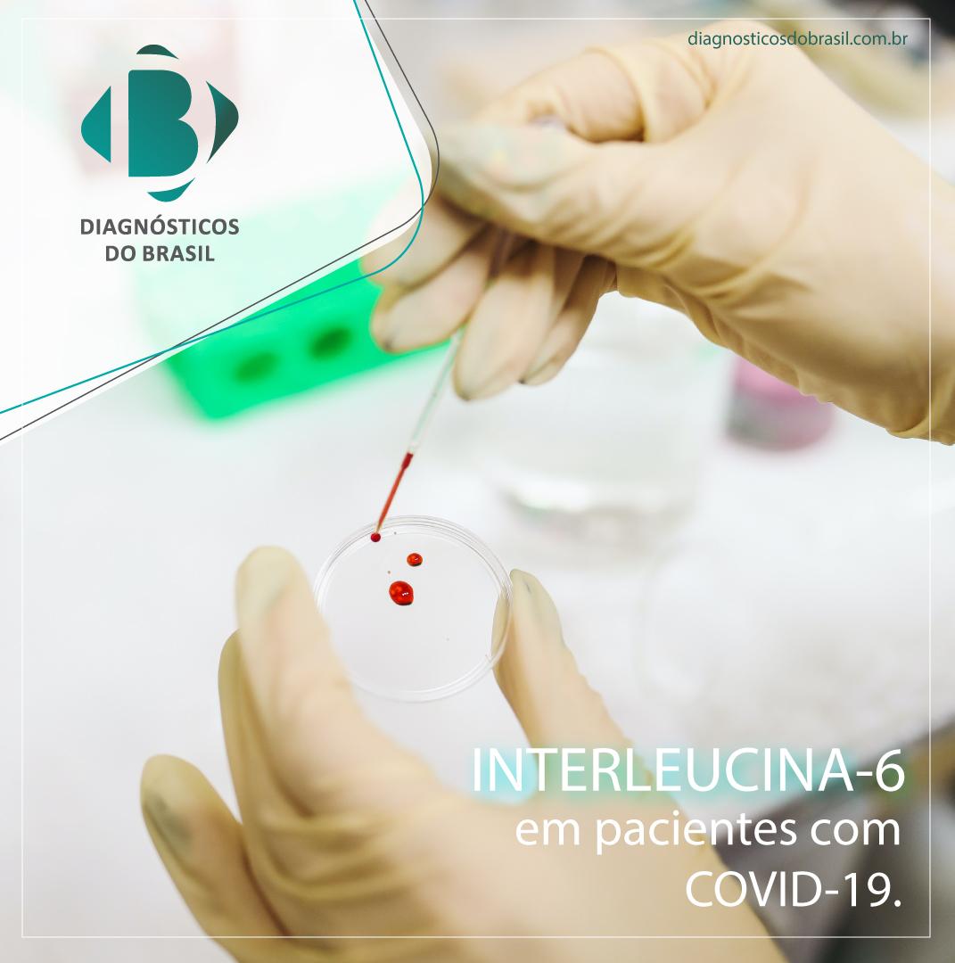 Interleucina 6 na Covid 19 | Diagnósticos do Brasil