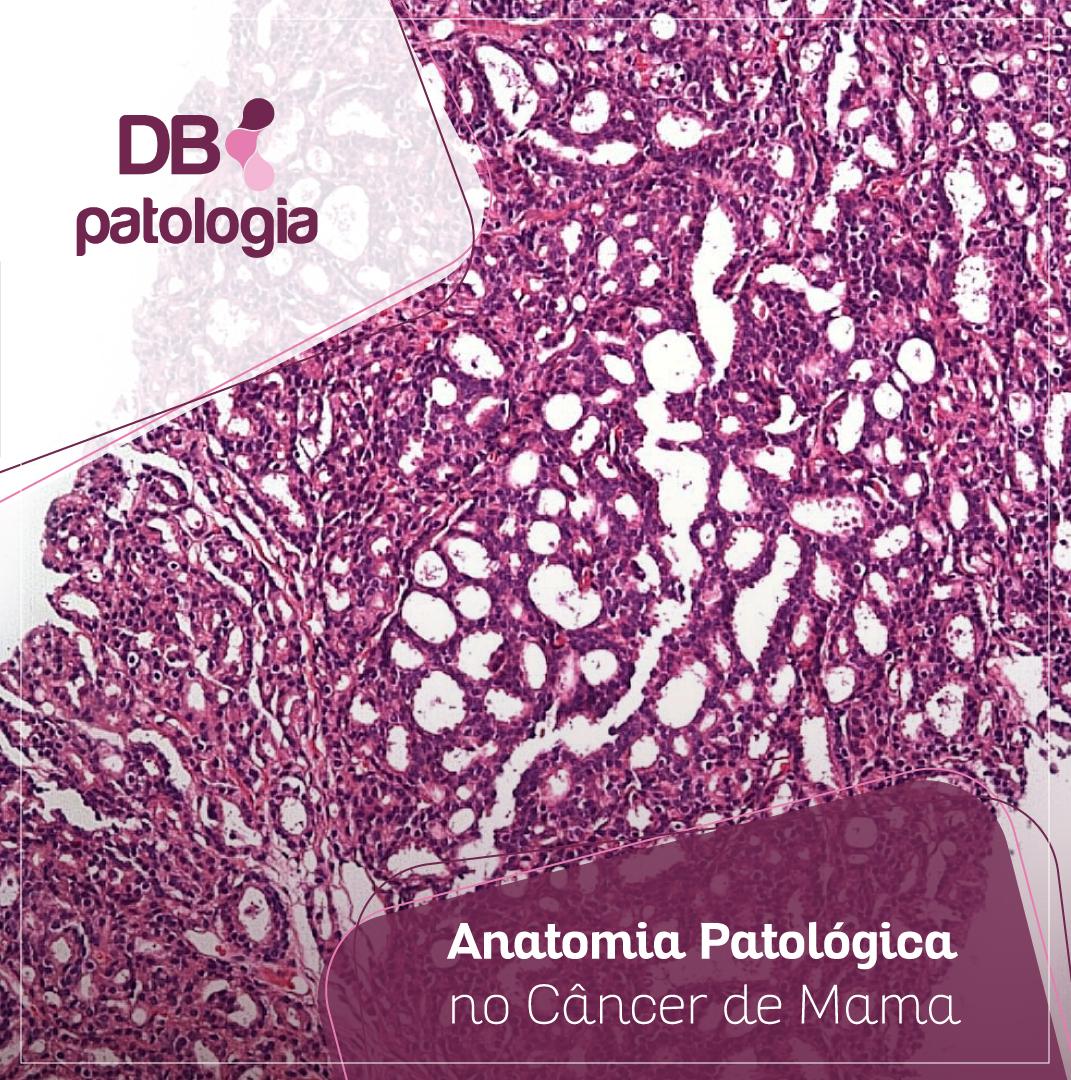 Anatomia Patológica no Câncer de Mama