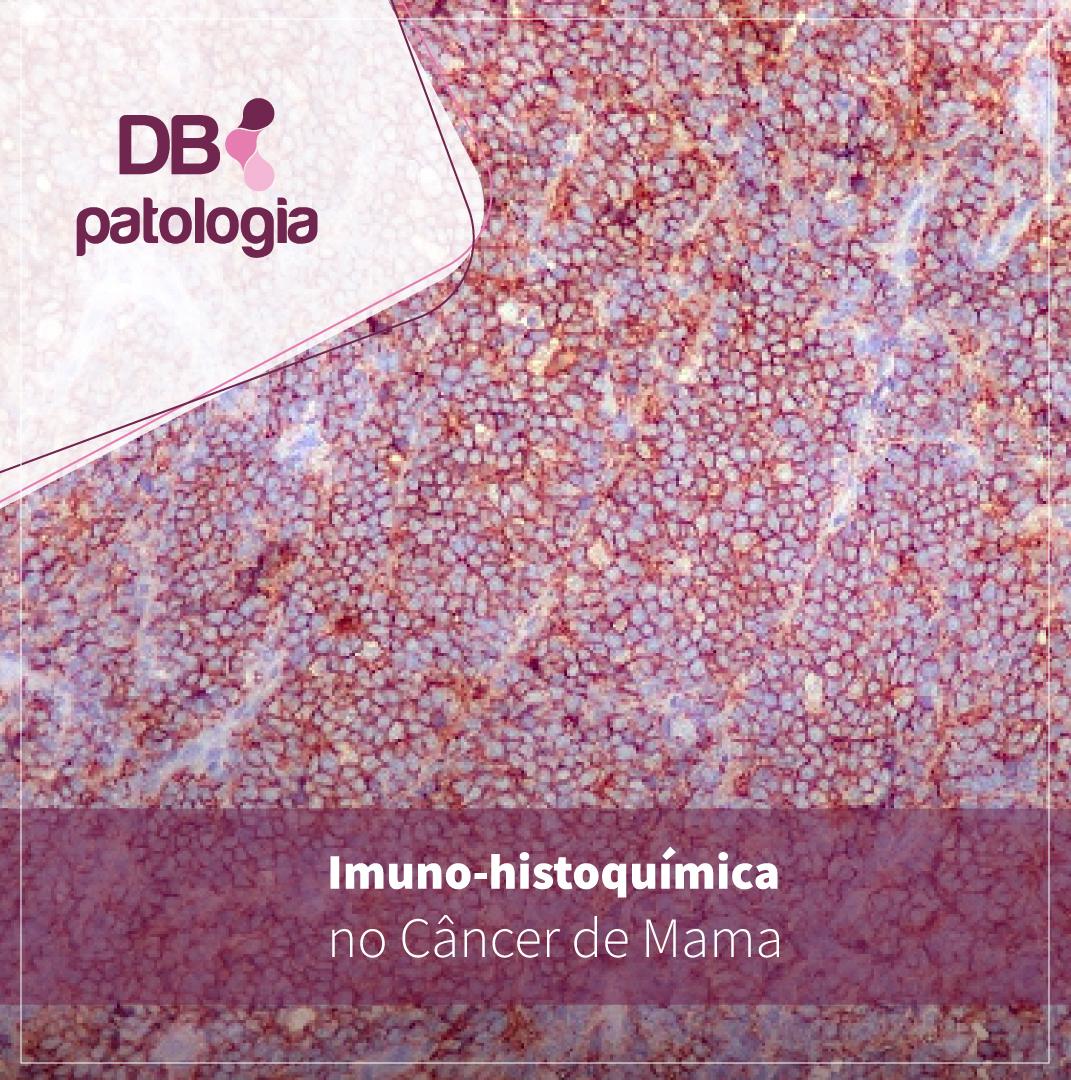 Imuno-histoquímica no Câncer de Mama