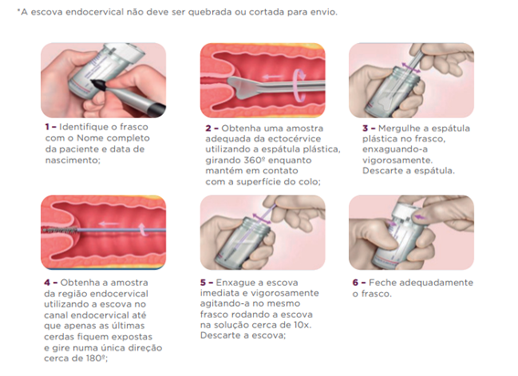 Citologia em Meio Líquido 