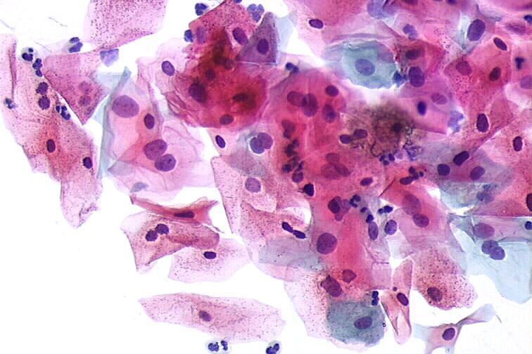 Citologia em Meio Líquido  | Diagnósticos do Brasil