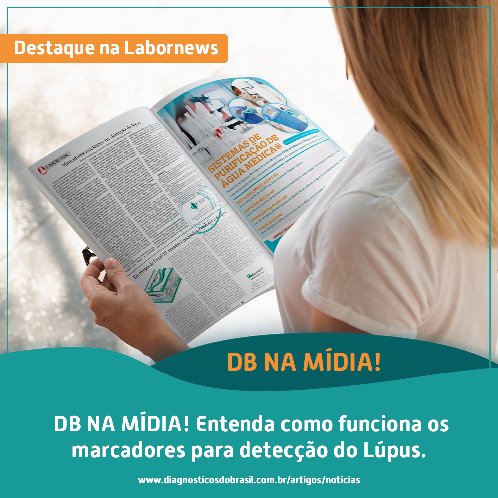 MARCADORES NUCLEARES NA DETECÇÃO DO LÚPUS | Diagnósticos do Brasil