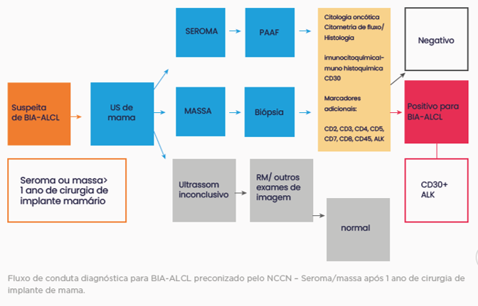 Lamina Linfoma anaplásico de grandes células (ALCL) associado ao implante mamário (BIA)