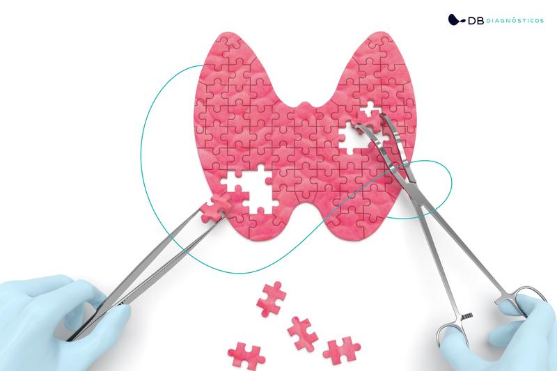 10 MITOS E VERDADES SOBRE A TIREOIDE  | Diagnósticos do Brasil