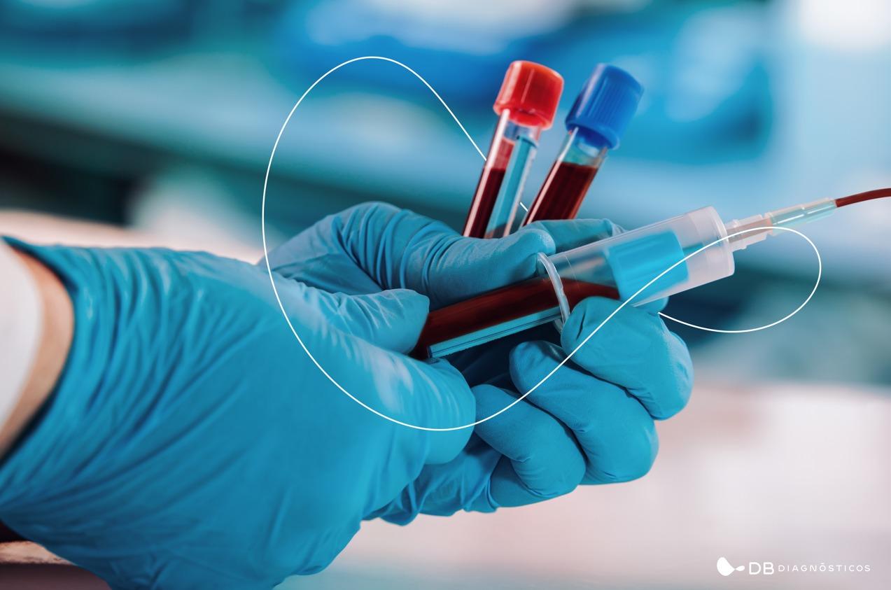 Do pré ao pós-analítico: Como funciona um exame de sangue? - Diagnósticos  do Brasil