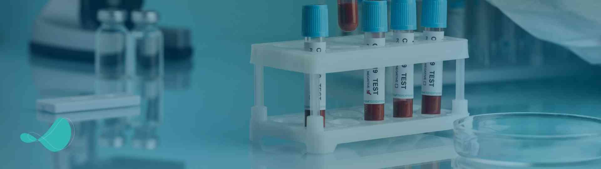 Análise comparativa das metodologias Elisa e Ensaio lipossomal para dosagem do CH50