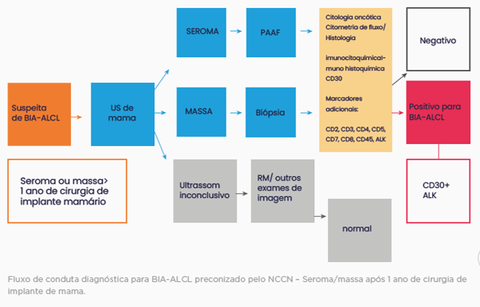 LÂMINA LINFOMA ANAPLÁSICO DE GRANDES CÉLULAS (ALCL) ASSOCIADO AO IMPLANTE MAMÁRIO (BIA)