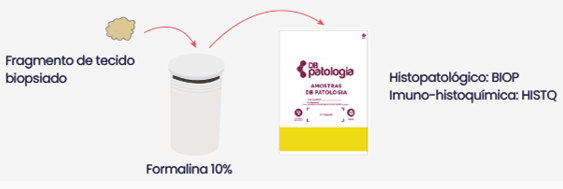 LÂMINA LINFOMA ANAPLÁSICO DE GRANDES CÉLULAS (ALCL) ASSOCIADO AO IMPLANTE MAMÁRIO (BIA)