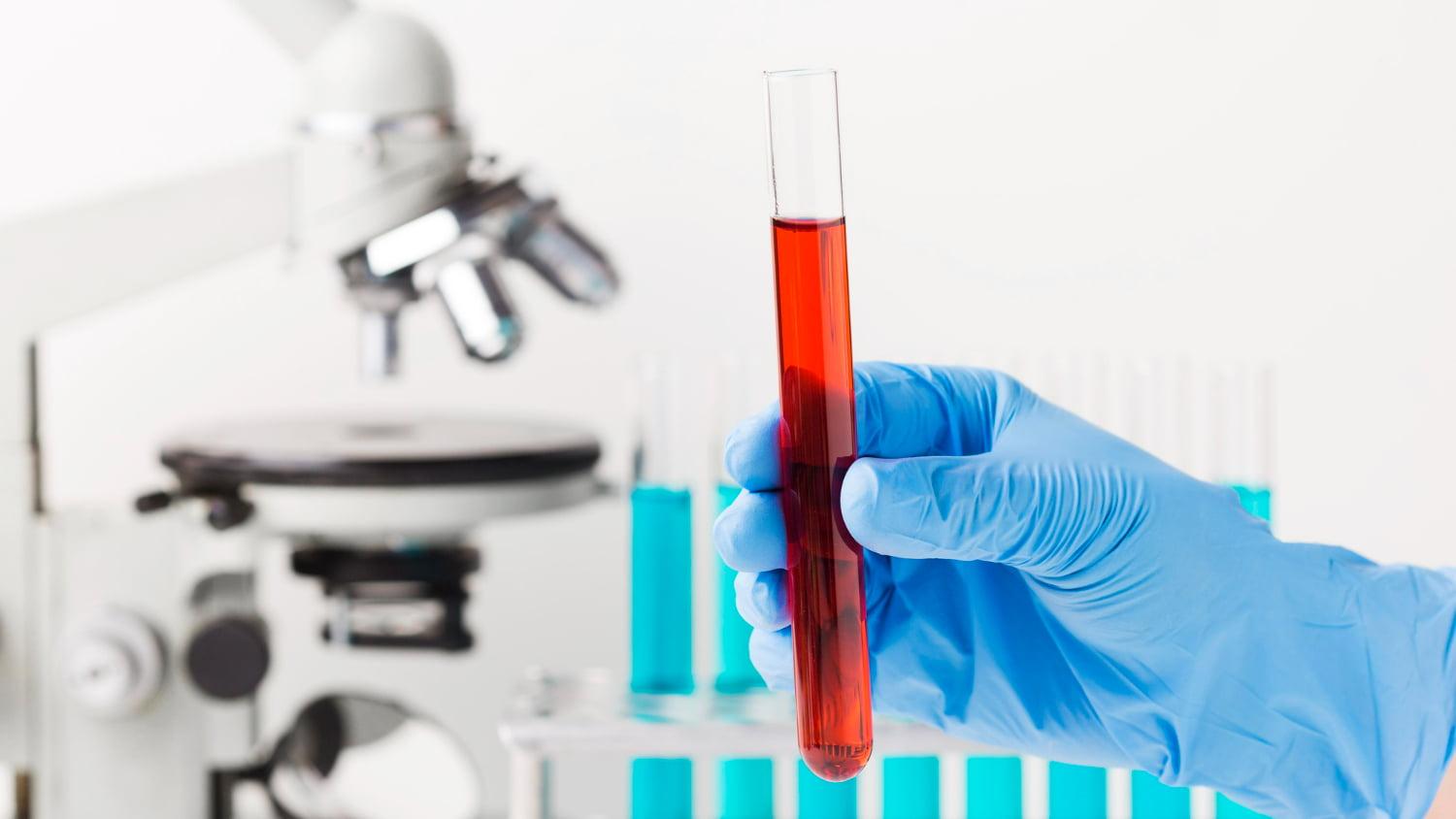A importância da terceirização de exames laboratoriais para clínicas e hospitais | Diagnósticos do Brasil: Referência em Apoio Laboratorial