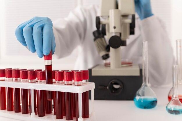 Exames laboratoriais: tudo o que você precisa saber