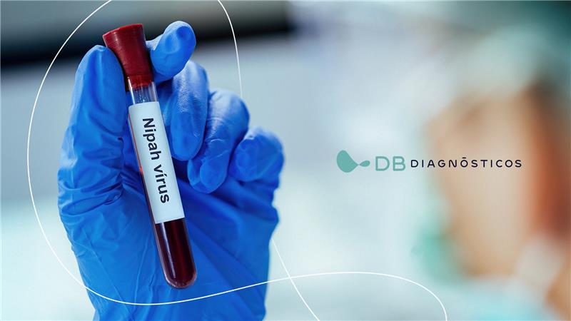 Vírus Nipah: o que é, como se transmite e porque acende um alerta para a saúde pública | Diagnósticos do Brasil: Referência em Apoio Laboratorial